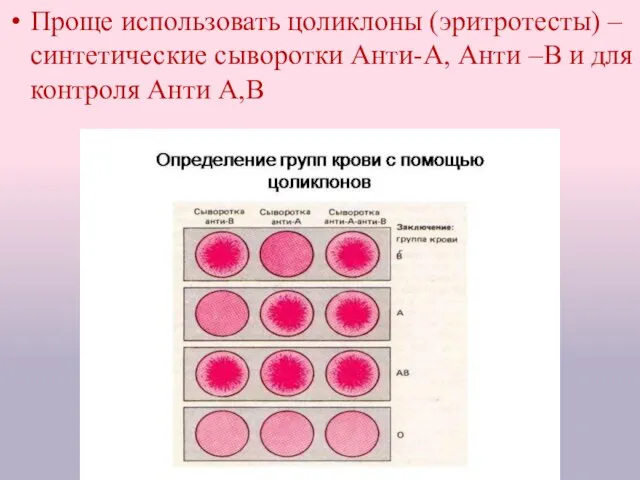 Проще использовать цоликлоны (эритротесты) – синтетические сыворотки Анти-А, Анти –В и для контроля Анти А,В