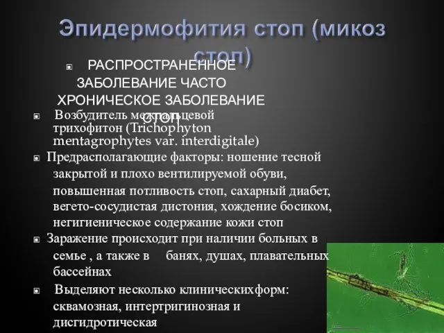 ▣ РАСПРОСТРАНЕННОЕ ЗАБОЛЕВАНИЕ ЧАСТО ХРОНИЧЕСКОЕ ЗАБОЛЕВАНИЕ СТОП ▣ Возбудитель межпальцевой трихофитон (Trichophyton