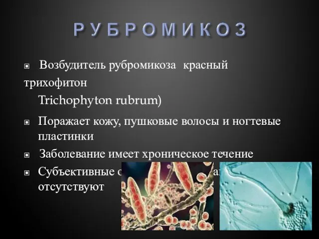 ▣ Возбудитель рубромикоза красный трихофитон Trichophyton rubrum) ▣ Поражает кожу, пушковые волосы