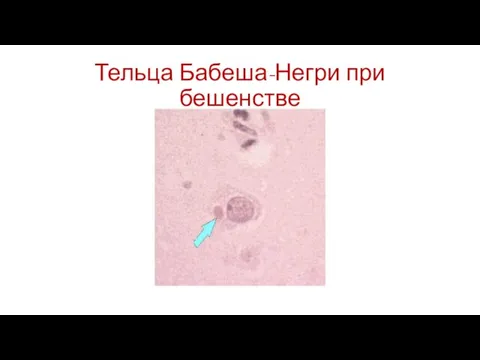 Тельца Бабеша-Негри при бешенстве