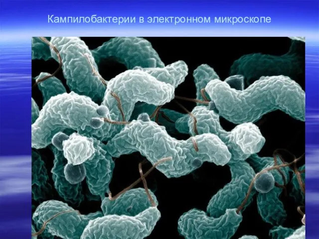 Кампилобактерии в электронном микроскопе
