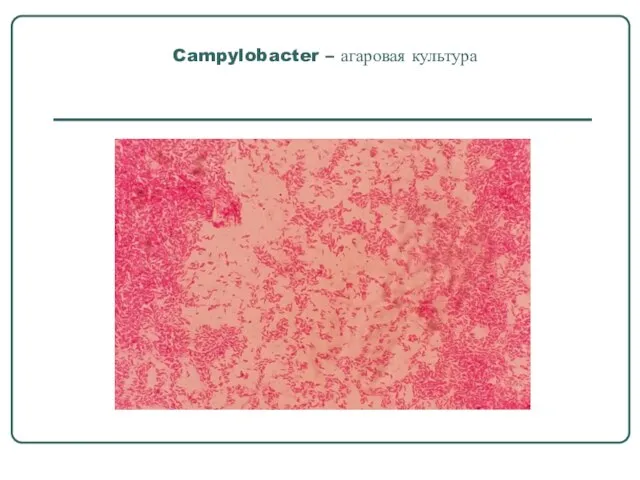 Campylobacter – агаровая культура