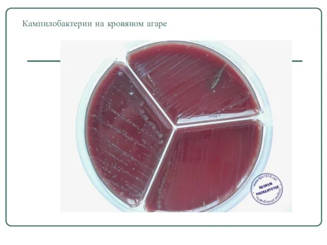 Кампилобактерии на кровяном агаре