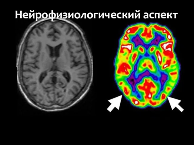 Нейрофизиологический аспект