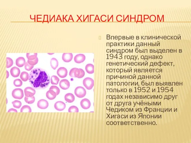 ЧЕДИАКА ХИГАСИ СИНДРОМ Впервые в клинической практики данный синдром был выделен в