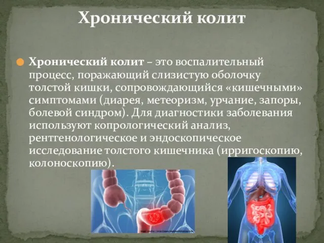 Хронический колит – это воспалительный процесс, поражающий слизистую оболочку толстой кишки, сопровождающийся