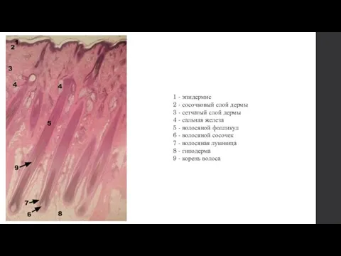 1 - эпидермис 2 - сосочковый слой дермы 3 - сетчатый слой