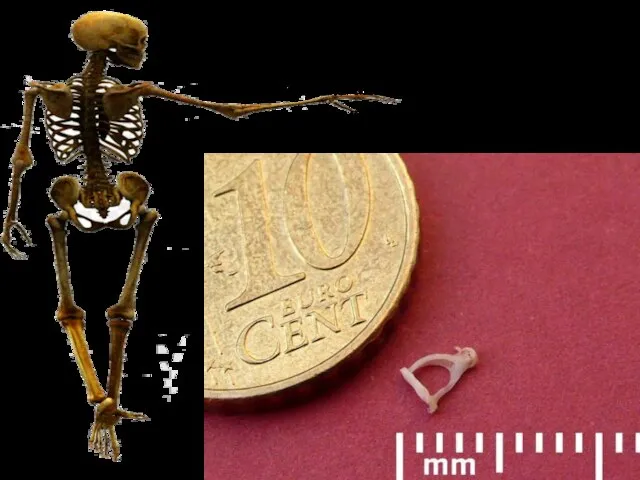 Самая маленькая и самая легкая кость человеческого скелета находится в среднем ухе.