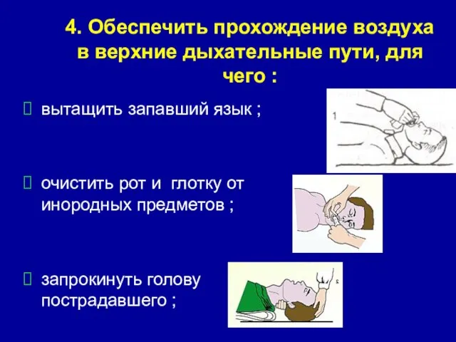 4. Обеспечить прохождение воздуха в верхние дыхательные пути, для чего : вытащить