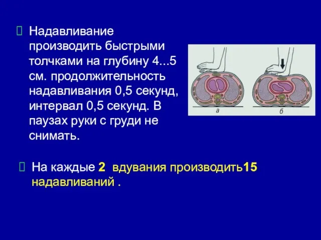 Надавливание производить быстрыми толчками на глубину 4...5 см. продолжительность надавливания 0,5 секунд,