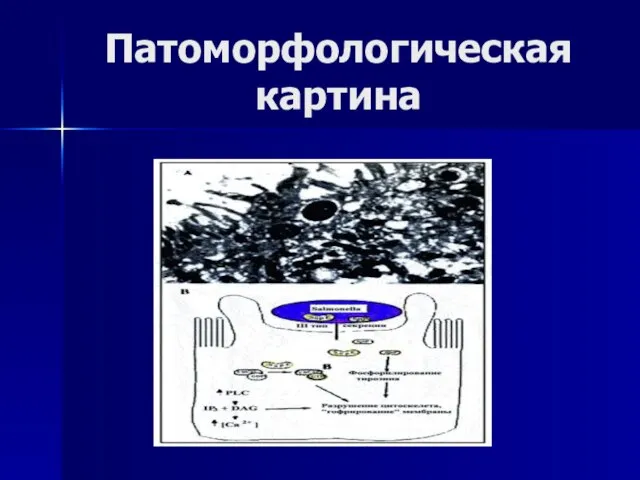 Патоморфологическая картина