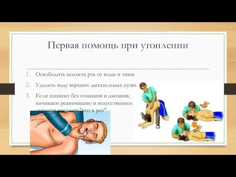 Первая помощь при утоплении Освободить полость рта от воды и тины Удалить