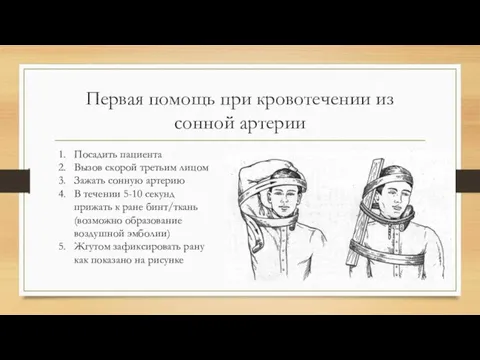 Первая помощь при кровотечении из сонной артерии Посадить пациента Вызов скорой третьим