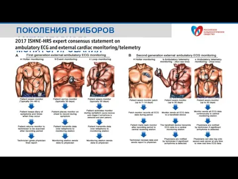 ПОКОЛЕНИЯ ПРИБОРОВ АМБУЛАТОРНОГО МОНИТОРИРОВАНИЯ