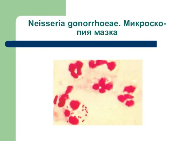 Neisseria gonorrhoeae. Микроско- пия мазка
