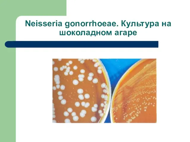 Neisseria gonorrhoeae. Культура на шоколадном агаре