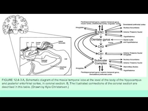 FIGURE 12.4-3 A, Schematic diagram of the mesial temporal lobe at the