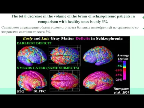 The total decrease in the volume of the brain of schizophrenic patients