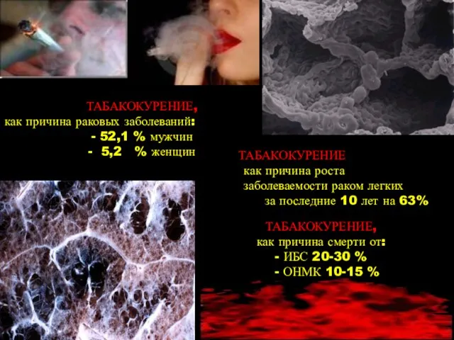 ТАБАКОКУРЕНИЕ, как причина раковых заболеваний: - 52,1 % мужчин - 5,2 %