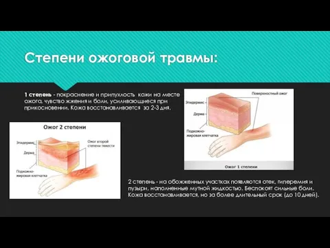 Степени ожоговой травмы: 1 степень - покраснение и припухлость кожи на месте