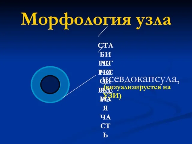 Морфология узла псевдокапсула, (визуализируется на УЗИ)