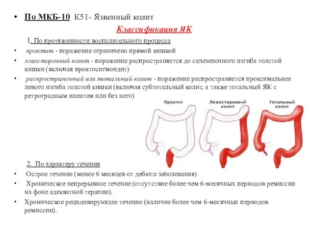 По МКБ-10 К51- Язвенный колит Классификация ЯК 1. По протяженности воспалительного процесса