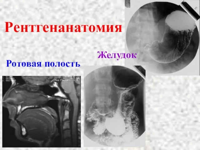 Рентгенанатомия Ротовая полость Желудок