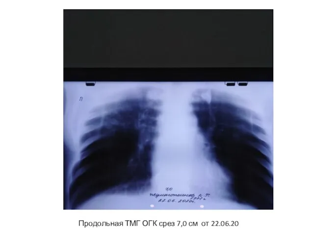 Продольная ТМГ ОГК срез 7,0 см от 22.06.20