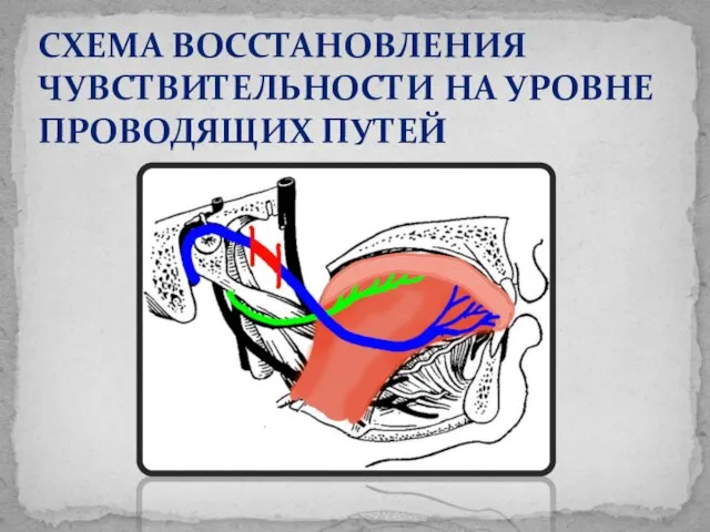 СХЕМА ВОССТАНОВЛЕНИЯ ЧУВСТВИТЕЛЬНОСТИ НА УРОВНЕ ПРОВОДЯЩИХ ПУТЕЙ