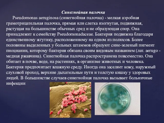 Синегнойная палочка Pseudomonas aeruginosa (синегнойная палочка) - мелкая аэробная грамотрицательная палочка, прямая