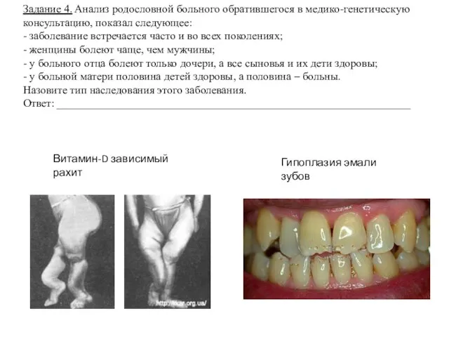 Задание 4. Анализ родословной больного обратившегося в медико-генетическую консультацию, показал следующее: -