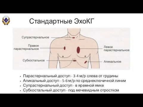 Стандартные ЭхоКГ позиции Парастернальный доступ - 3-4 м/р слева от грудины Апикальный