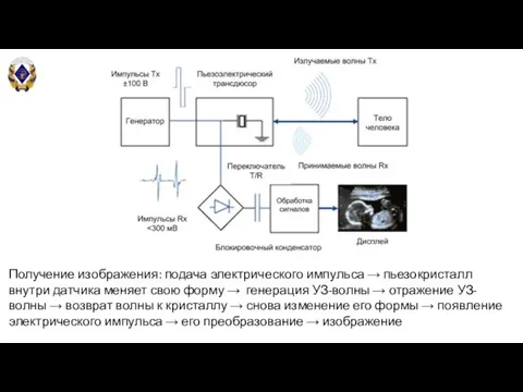 Получение изображения: подача электрического импульса → пьезокристалл внутри датчика меняет свою форму