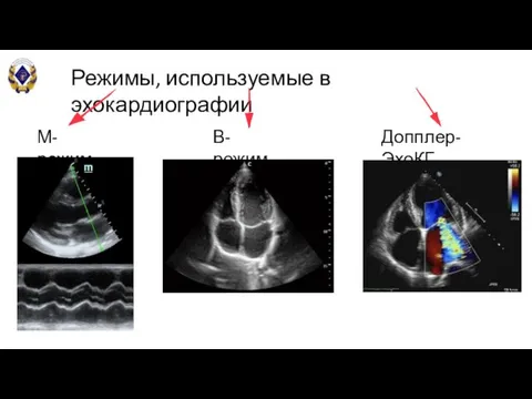 Режимы, используемые в эхокардиографии М-режим В-режим Допплер-ЭхоКГ