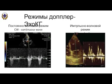 Постоянно-волновой режим CW - continuous wave Импульсно-волновой режим PW - pulsed wave Режимы допплер-ЭхоКГ