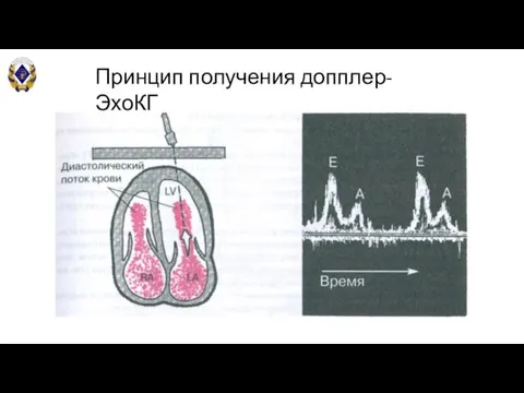 Принцип получения допплер-ЭхоКГ