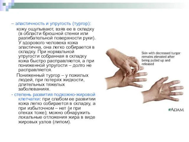 – эластичность и упругость (тургор): кожу ощупывают, взяв ее в складку (в