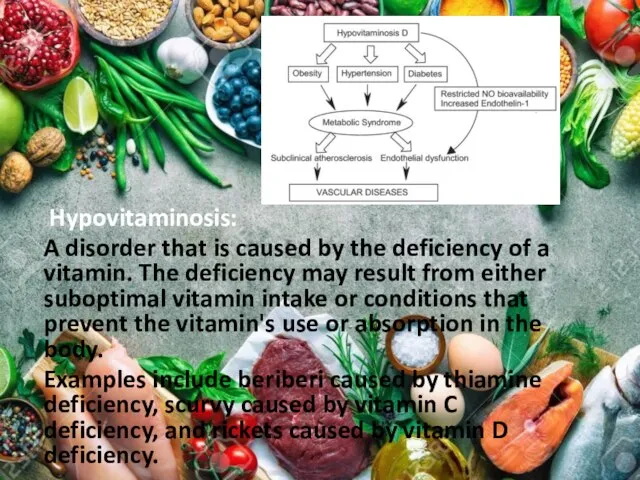 Hypovitaminosis: A disorder that is caused by the deficiency of a vitamin.