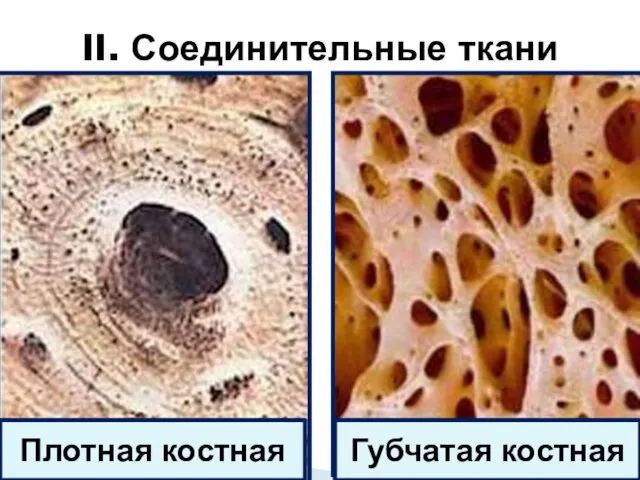 II. Соединительные ткани Губчатая костная Плотная костная