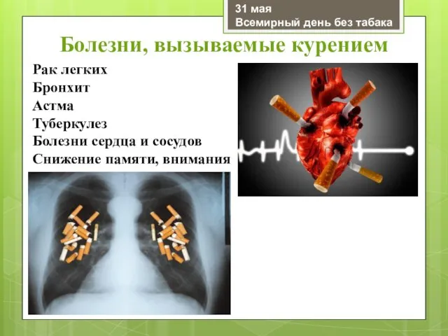 Рак легких Бронхит Астма Туберкулез Болезни сердца и сосудов Снижение памяти, внимания