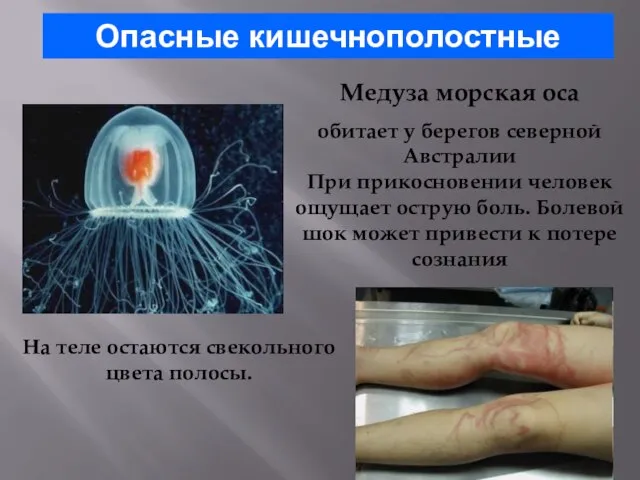 Опасные кишечнополостные Медуза морская оса обитает у берегов северной Австралии При прикосновении