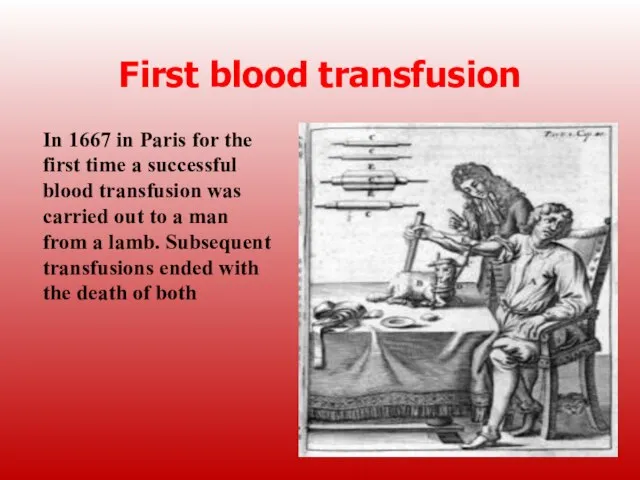 First blood transfusion In 1667 in Paris for the first time a