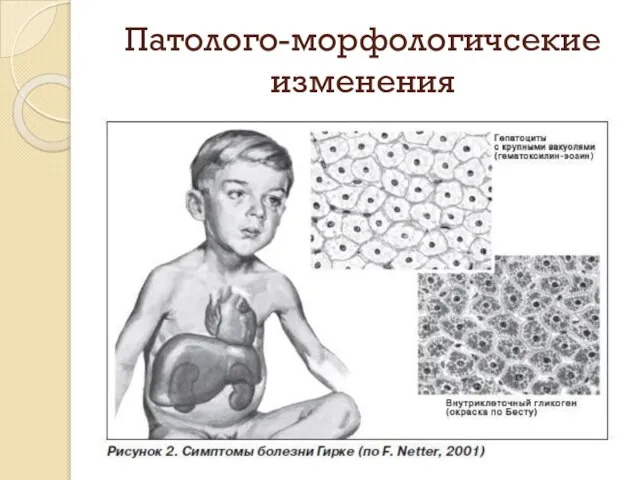 Патолого-морфологичсекие изменения