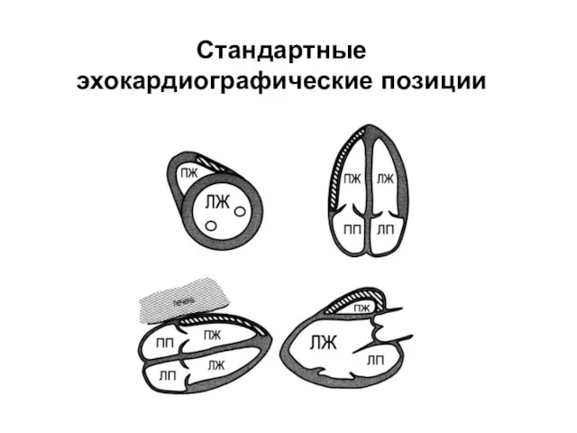 Стандартные эхокардиографические позиции