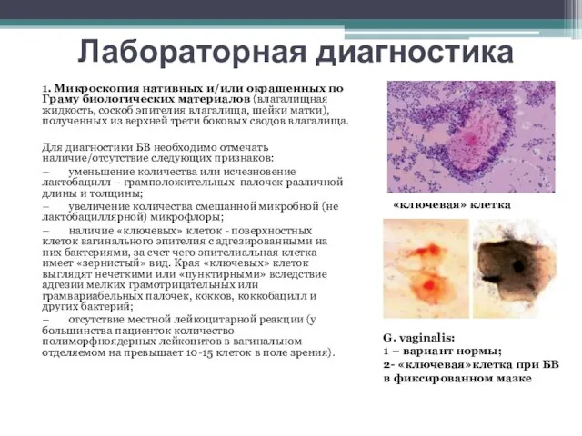 Лабораторная диагностика 1. Микроскопия нативных и/или окрашенных по Граму биологических материалов (влагалищная
