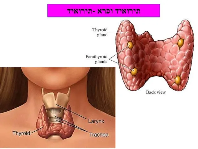 תירואיד ופרא -תירואיד