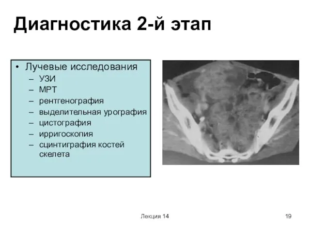 Лекция 14 Диагностика 2-й этап Лучевые исследования УЗИ МРТ рентгенография выделительная урография