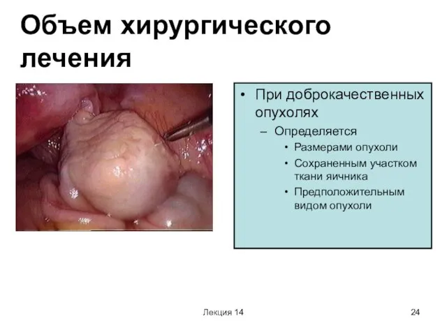 Лекция 14 Объем хирургического лечения При доброкачественных опухолях Определяется Размерами опухоли Сохраненным