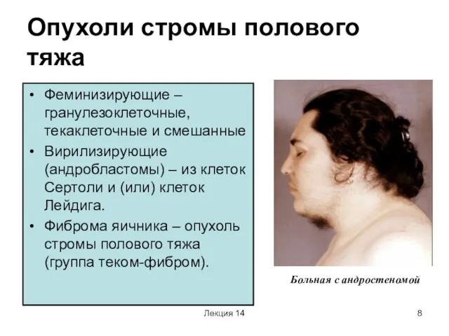 Лекция 14 Опухоли стромы полового тяжа Феминизирующие – гранулезоклеточные, текаклеточные и смешанные