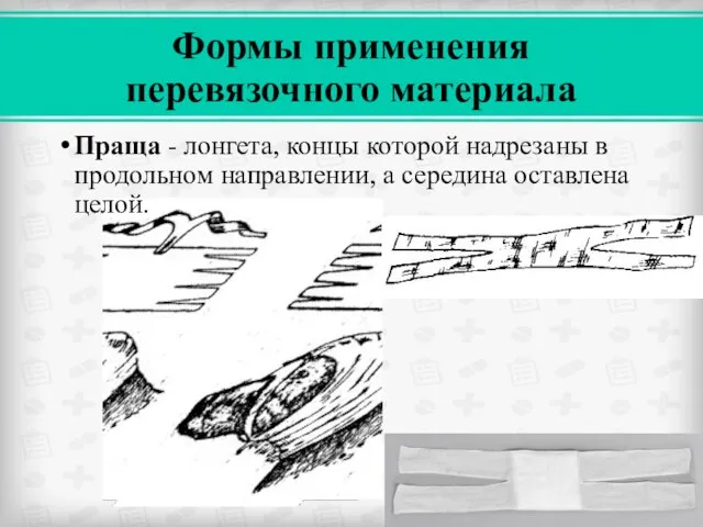 Формы применения перевязочного материала Праща - лонгета, концы которой надрезаны в продольном